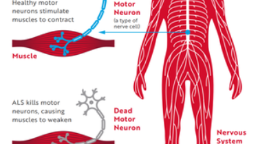 Liečba včelím jedom a štúdie pre ALS