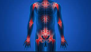 Včelí jed na liečbu zápalov